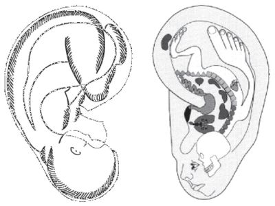 Auricular Conceptual Mapping - The upside down homunculus