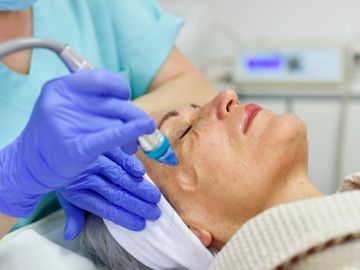 Woman receiving microdermabrasion by esthetician