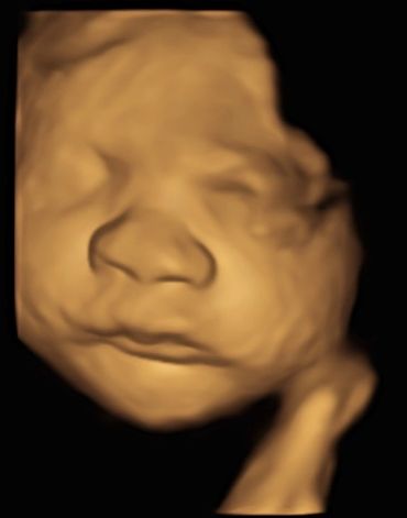 4d-baby-scan-little-miracles-sonography-delph-oldham-manchester