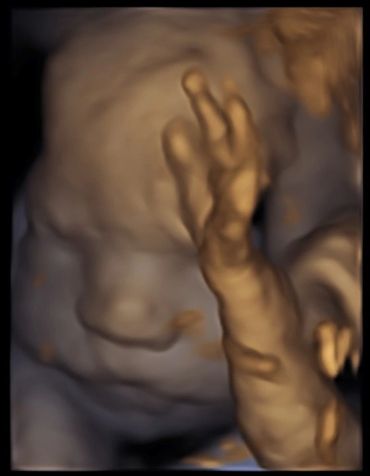 3d-baby-scan-sonography-oldham-reassurance-scan