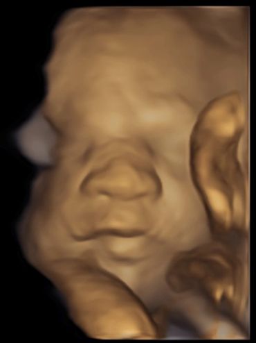 bayscan-babyface-3d-babyscan-clinic-oldham-greater-manchester