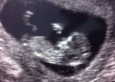 2d-babyscan-early-ultrasound-images-qualified-sonographers-manchester