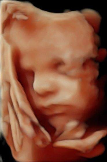 3d-scan-baby-boy-ultrasound-oldham