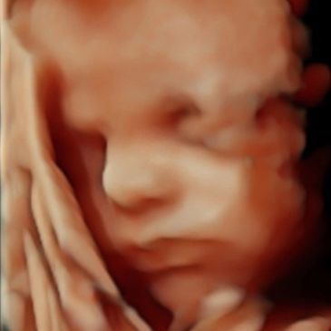 3d-baby-scan-image-of-babys-face