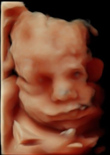 4d-babyscan-image-of-babys-face