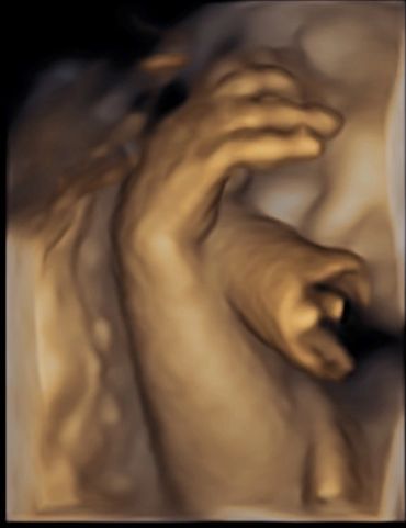 3d-baby-scan-hands-amazing-sonography
