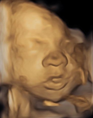 3d-baby-scan-3d-4d-baby-bonding-scans-oldham-image-of-baby's-face