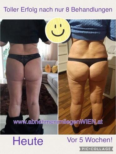 Renata in 1180 Wien Abnehmen im Liegen Erfolg nach 8 Behandlungen in 5 Wochen