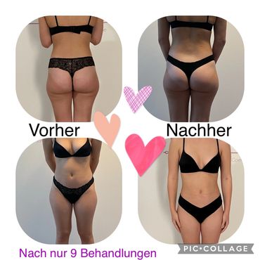 Toller Abnehmen im Liegen Erfolg nach 9 Behandlungen bei Renata in 1180 Wien
