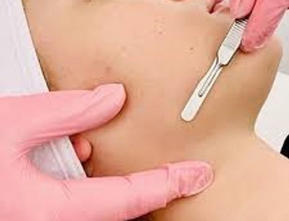 Dermaplaning service by Master Esthetician at Martens Beauty Co in Watchung NJ
