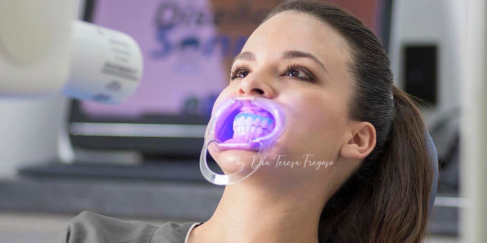 Diseño de Sonrisa, Odontología, Carillas dentales, Carillas de Resina, Blanqueamiento Dental