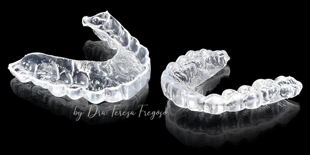 Diseño de Sonrisa, Odontología, Carillas dentales, Carillas de Resina, Dientes, Sonrisa Guardas
