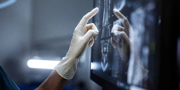 Mano con guante señalando una imagen médica en pantalla.