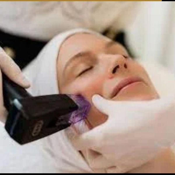 Promotion for Morpheus 8 and Lumecca facial treatments.