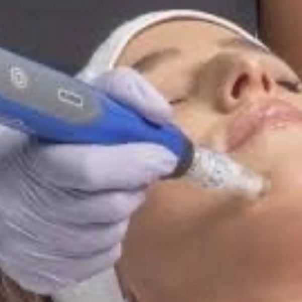 Promotion for skin pen treatments with a free dermaplaning add-on included.