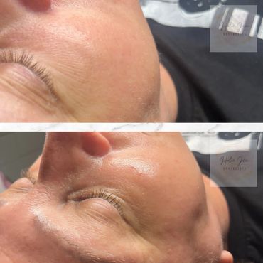 Got to facial at Halie Jean Aesthetics in Marlborough, MA