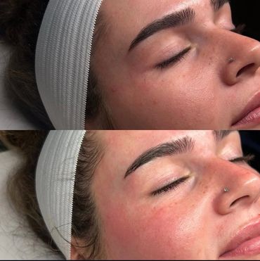 Facial at Halie Jean Aesthetics in Marlborough, MA