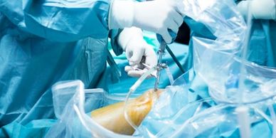 Arthroscopy surgery at Libberton Orthopedic Center