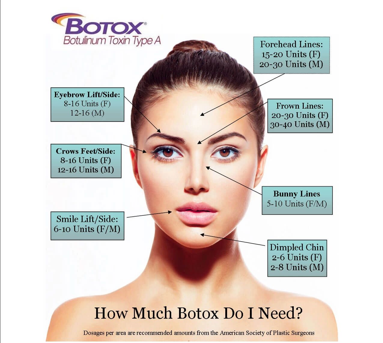 botox, medical spa, med spa, murfreesboro botox, murfreesboro filler