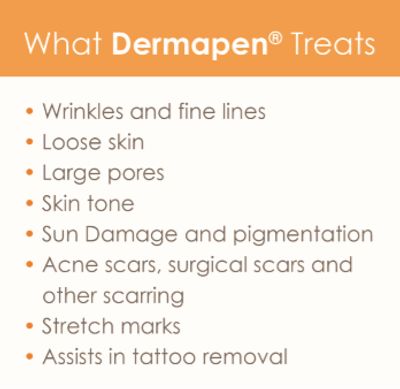 microdermabrasion, reduce wrinkle, large pores, scars, stretch marks, tattoo removal, murfreesboro
