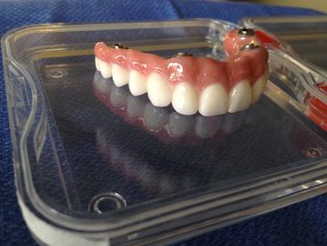 All-On-4 fixed hybrid denture.  Ceramic construction for highest esthetics and chewing comfort.