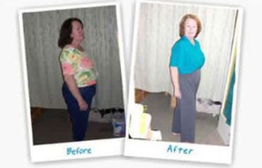 Before and After of Larainne Robeson