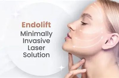 Endolift minimally invasive laser solution for facial treatment.