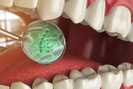 Desenho de uma boca com um espelho odontológico refletindo uma colônia de bactérias.