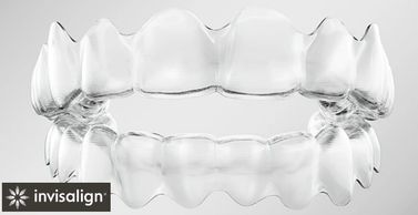 Placas transparentes de alinhador ortodôntico. Invisalign.