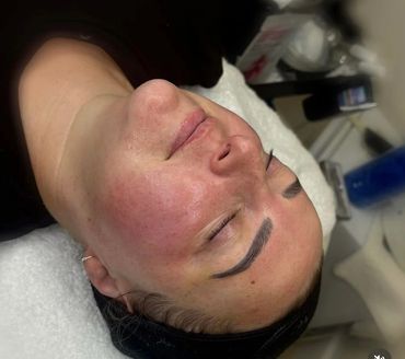 Glow & Go Facial Results