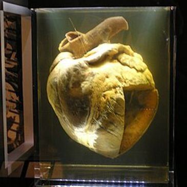 A preserved human heart on display.