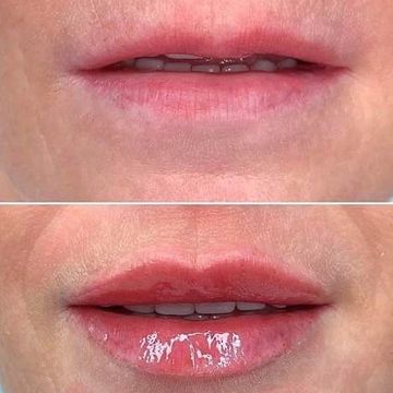 Lip Reconstruction (create a new shape)