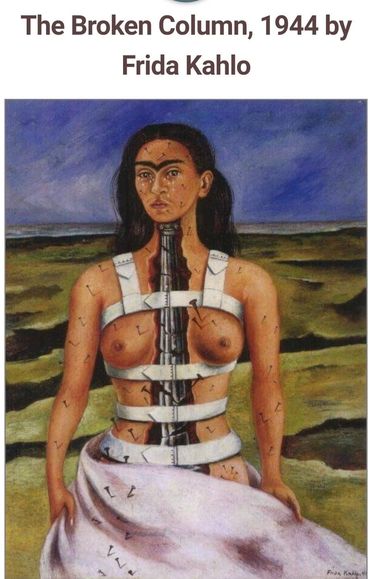 Painting of the Broken Column by Frida Kahlo.