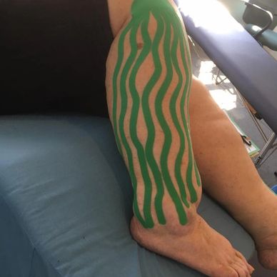 Kinesiology tape
Taping and Orthotics
First Step Recovery Model
10 Key Components