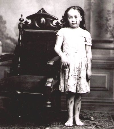Mary Ellen Wilson saved from child abuse in 1874 by the SPCA which expanded to protect children.