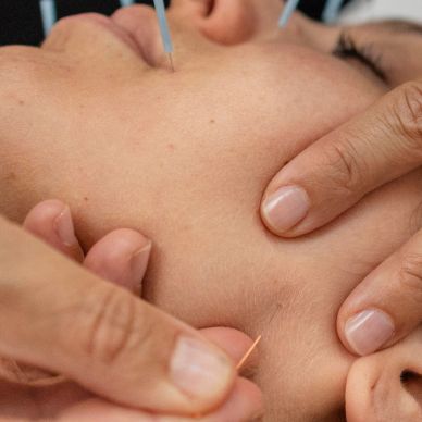 Facial acupuncture treatment, facial massage, relaxation massage, acupuncture, longevity, youthful,