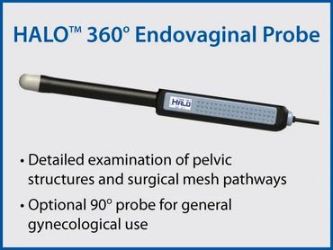 Endovaginal Probe 360