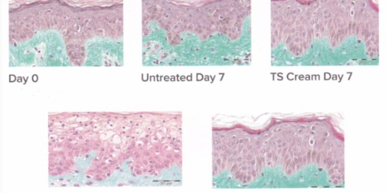 Retinol RetinA Lifevantage, Nrf2, Protandim