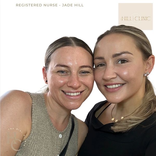 My gorgeous childhood friend coming in to see me after 20+ years for a skin treatment.