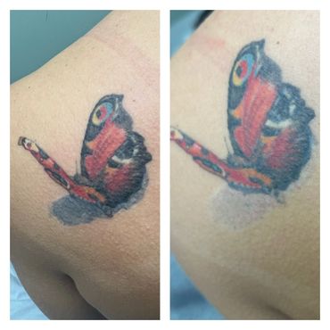 After just one session the colour of the pebble has really lifted. This was a fairly new tattoo