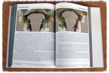 C:heek Teeth in Horses