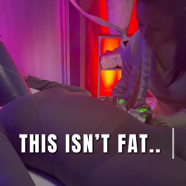 Laser lymphatic drainage treatment in Boardman, Ohio targeting abdominal fluid retention.