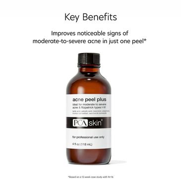Acne Treatment