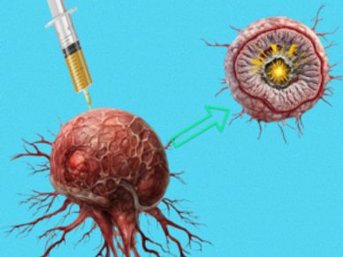 Tumor-Injected Chlorine Dioxide Infographic
