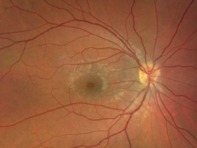 Inside of the eye