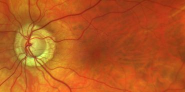 Inside of the eyeball