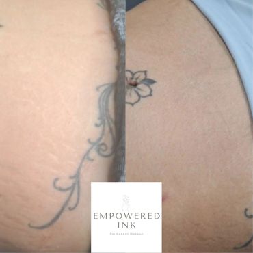 Stretch Mark Camouflage Tattoo