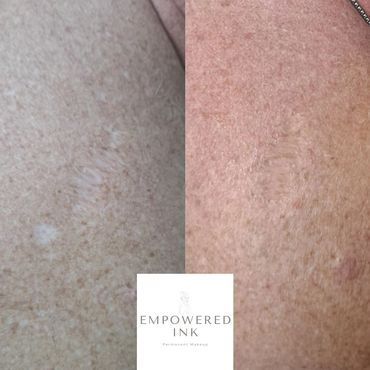 Scar Camouflage Tattoo, camo, skin tone ink,