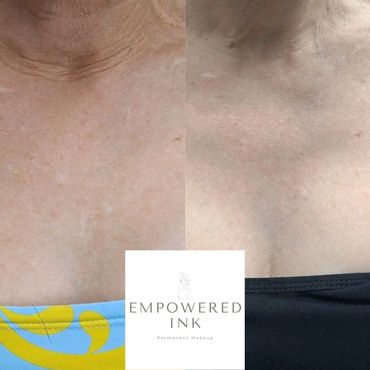 chest Scar Camouflage Tattoo