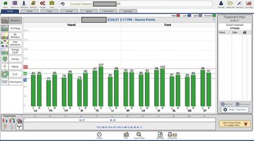 Acupuncture Acugraph, Tradition Chinese Medicine meridians Qi